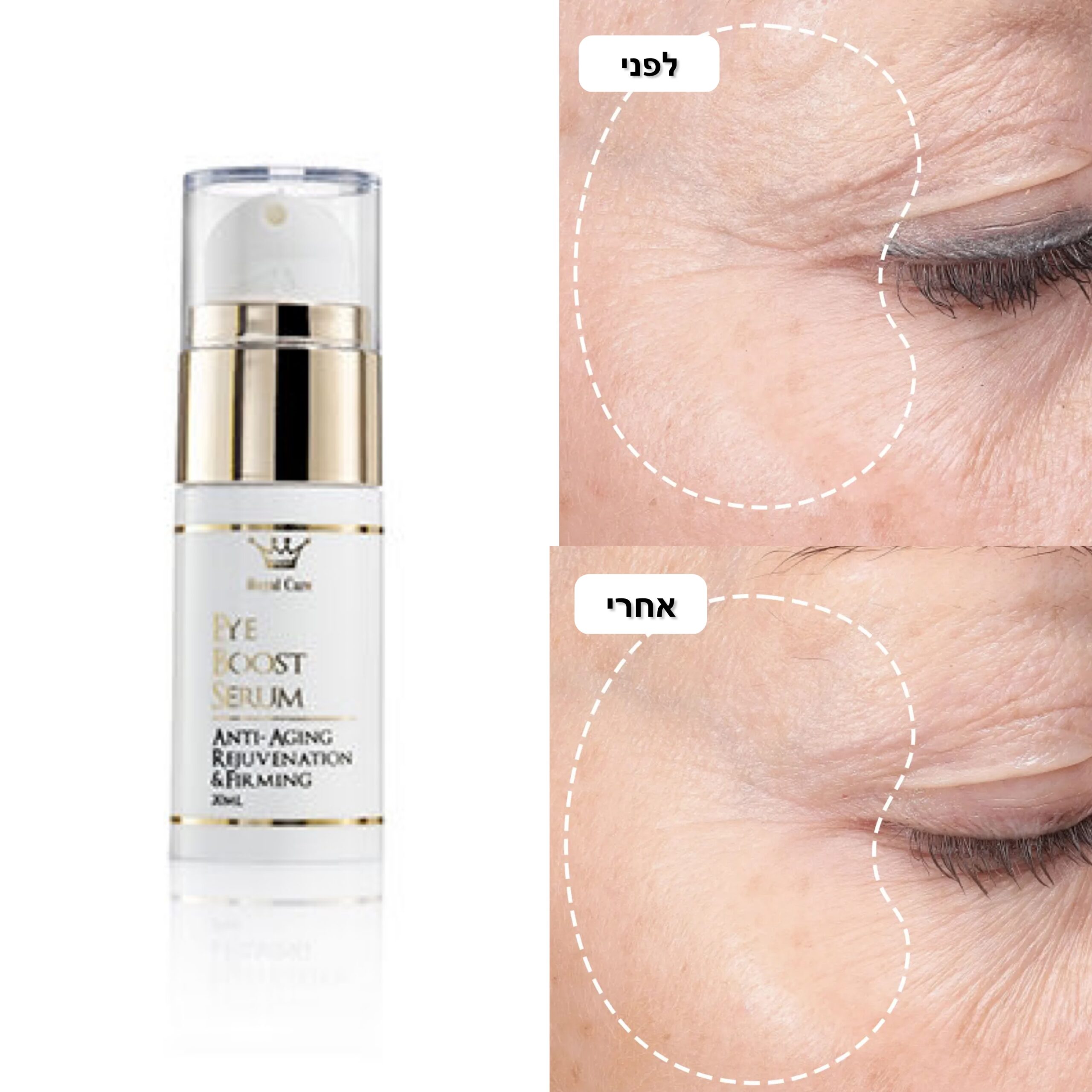 סרום עיניים Eye Boost Serum